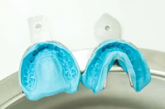 راهنمای خرید آلژینات دندانپزشکی